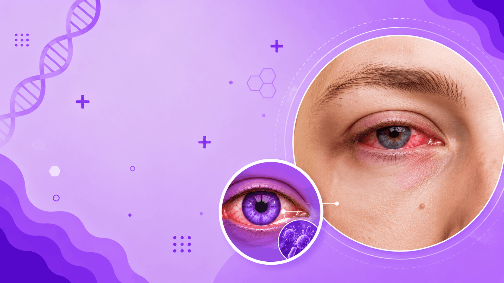Conjunctivitis Banner