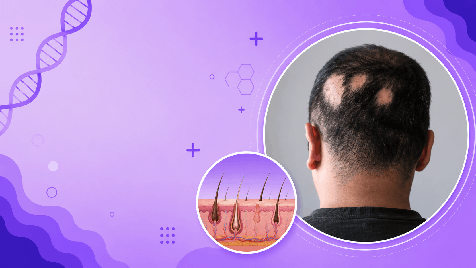 Hairloss Banner
